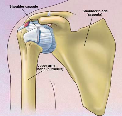 Frozen Shoulder